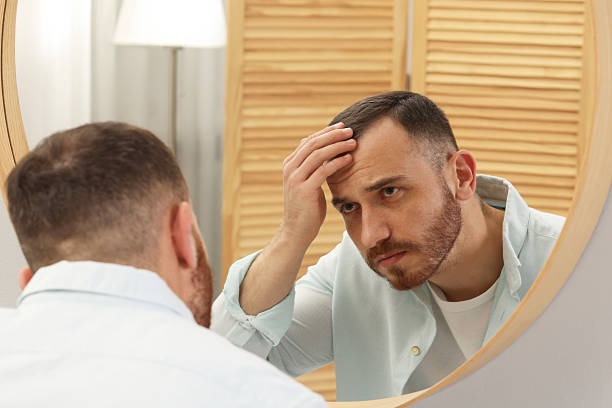 istock Baldness problem. Man with receding hairline near mirror at home 2245817163