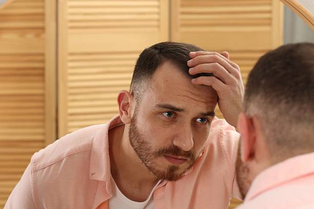 istock Baldness problem. Man with receding hairline near mirror at home 2245817198