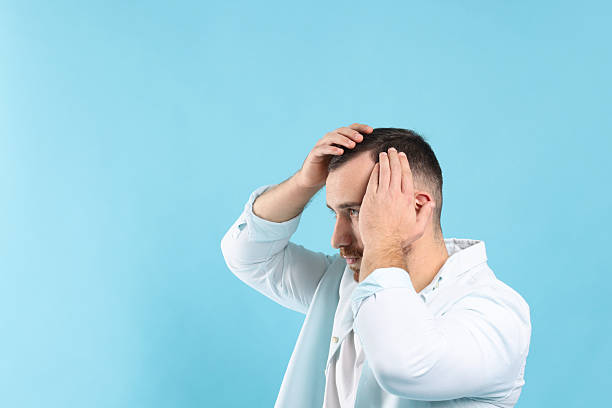 istock Baldness problem. Man with receding hairline on light blue background, space for text 2245817205