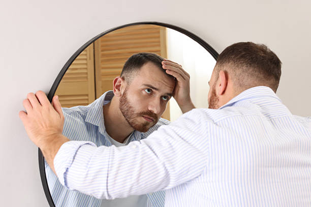 istock Baldness problem. Man with receding hairline near mirror at home 2245817219