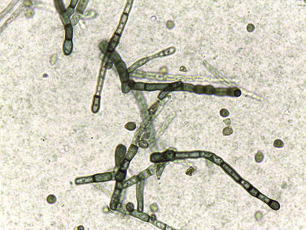 istock Fungal pathology: Barrel-shaped hyphal fragments and budding cells under high magnification. 2245838311