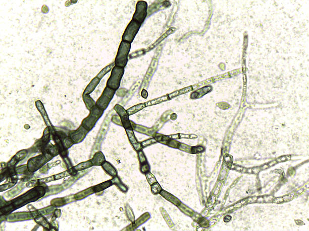 istock Fungal pathology: Barrel-shaped hyphal fragments and budding cells under high magnification. 2245838333