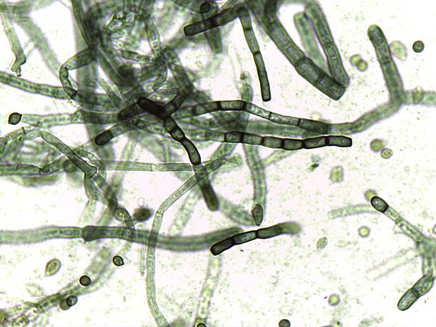 istock Fungal pathology: Barrel-shaped hyphal fragments and budding cells under high magnification. 2245838368