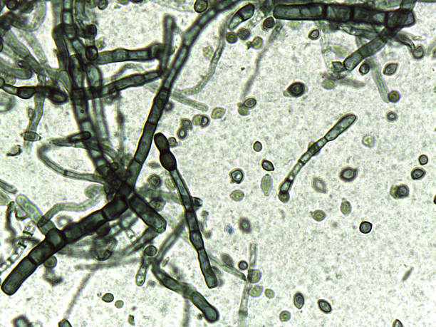 istock Fungal pathology: Barrel-shaped hyphal fragments and budding cells under high magnification. 2245838383