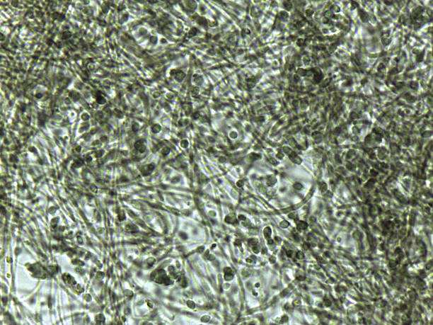 istock Fungal pathology: Barrel-shaped hyphal fragments and budding cells under high magnification. 2245838559