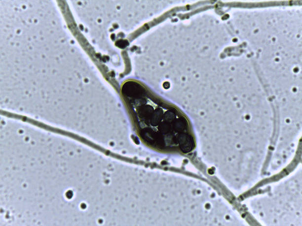 istock Micrograph showing a dense field of dark, oval, thick-walled fungal spores, likely melanized. 2245838932