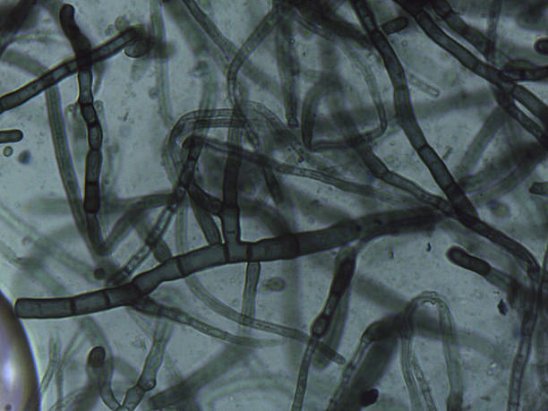 istock Mycelial network: Magnified view of the thick, branched, and septated vegetative tissue. 2245841584