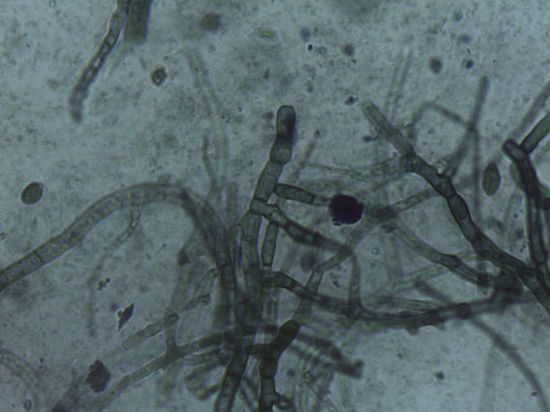 istock Mycelial network: Magnified view of the thick, branched, and septated vegetative tissue. 2245841587