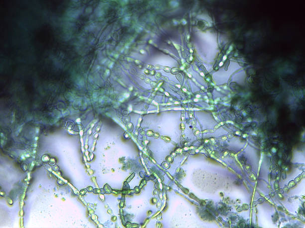 istock Mycelial network: Magnified view of the thick, branched, and septated vegetative tissue. 2245841625