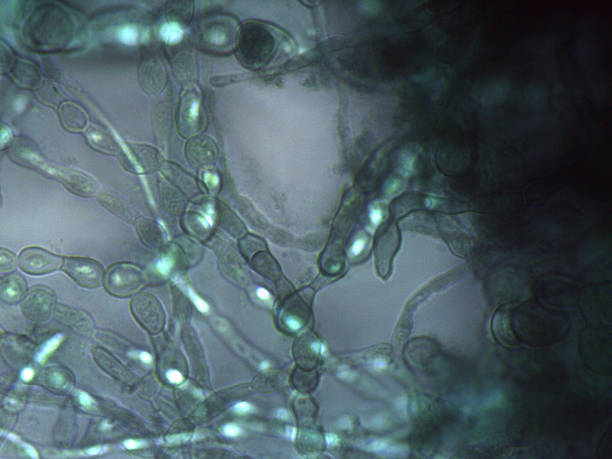 istock Mycelial network: Magnified view of the thick, branched, and septated vegetative tissue. 2245841653