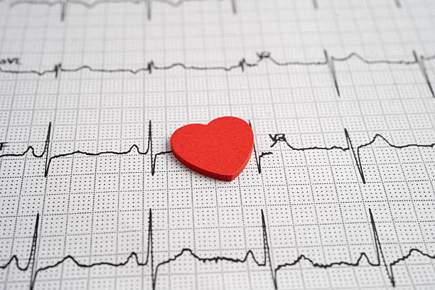 istock Electrocardiogram ECG heart wave, heart attack, cardiogram report. 2245933633