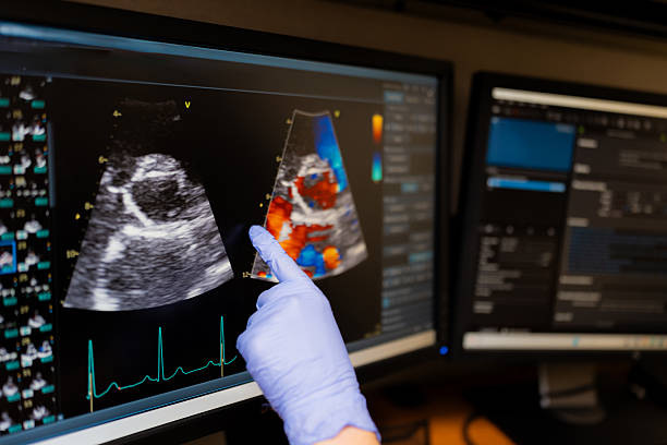Medical professional pointing to heart image on an ultrasound screen, performing cardiac diagnosis and health examination