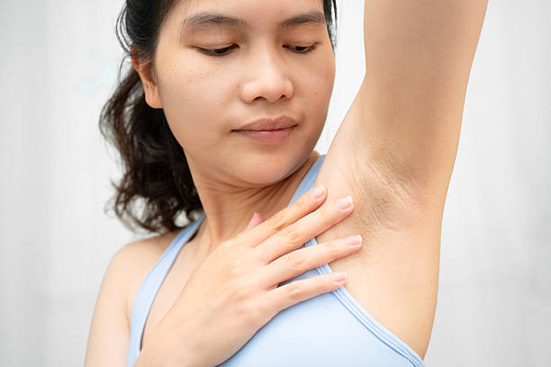 istock Asian woman have problem black armpit beauty skin care. 2246116548