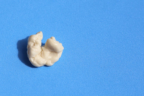 istock A small, chewed piece of gum sits on a vibrant blue surface 2247620483