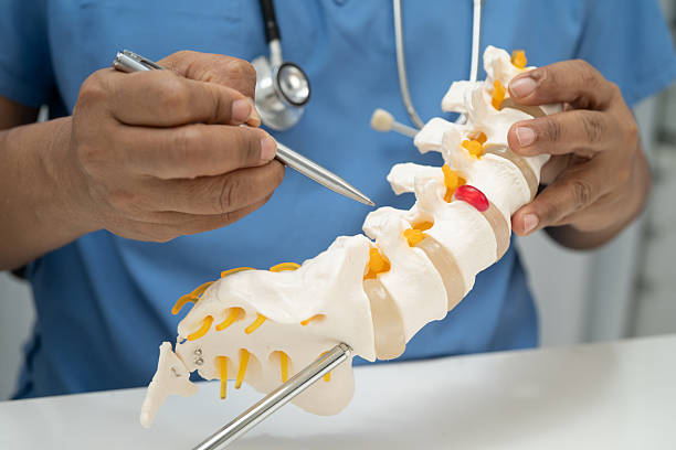 istock Asian doctor holding spinal nerve and bone model, Lumbar spine displaced herniated disc fragment for treatment medical in the orthopedic department. 2247641961