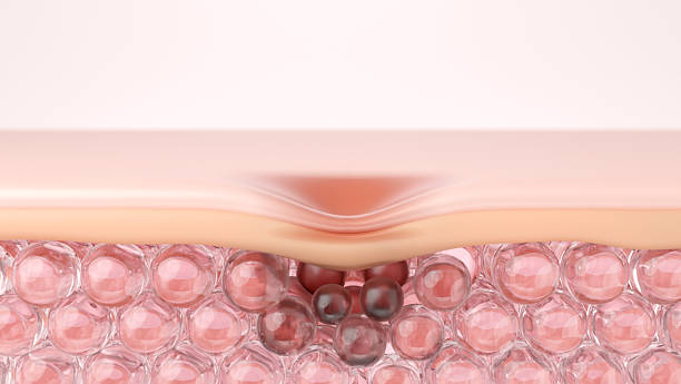 istock Melanin Hyperpigmentation and Acne Scar Depression on Skin, 3D Illustration 2247731387