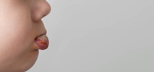 Close-up of a woman's mouth on white background. Shallow depth of field.