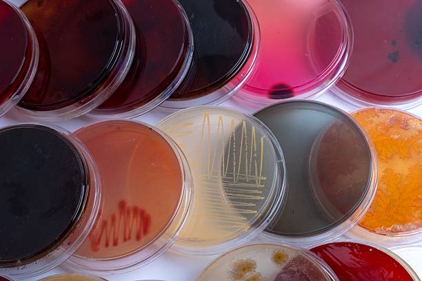 istock Colorful petri dishes with bacterial cultures 2248761296