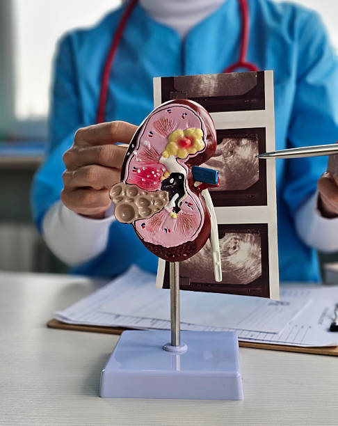 istock Medical professional explains kidney model alongside ultrasound images 2249044641