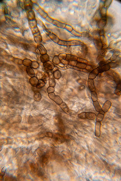istock A high-magnification micrograph showing chains of dark, barrel-shaped fungal arthroconidia or chlamydospores arising from septate, pigmented hyphae, indicative of certain molds 2249149248
