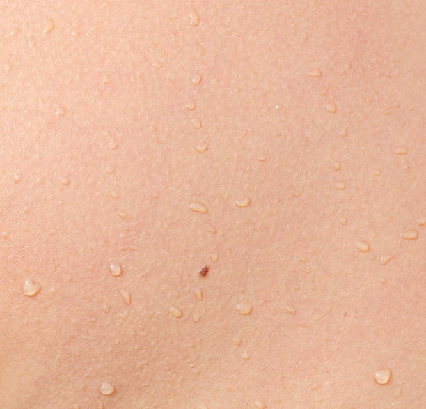 istock A person's back with water droplets on it 2249280660