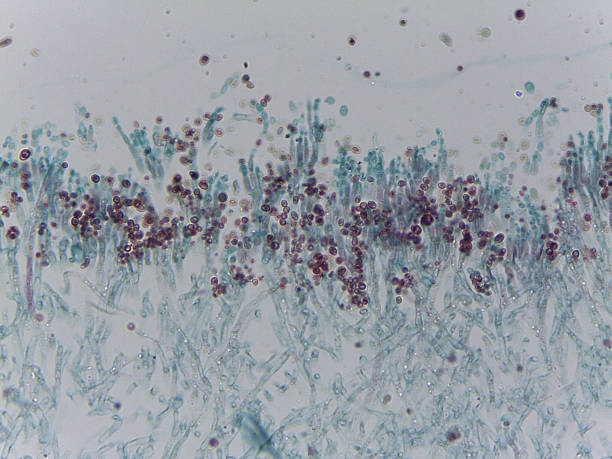 istock Stained Micrograph of Penicillium Fungi Conidia Spore Formation and Release from Conidiophores for Mycology Rese 2249388827