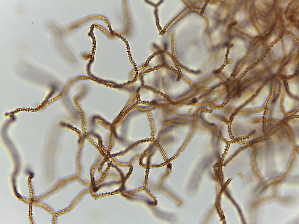 istock Detailed Microscopic View of Slime Mold Spore Dispersal Structures: Intricate Brown Capillitial Threads of Arcyria Ge 2249390148