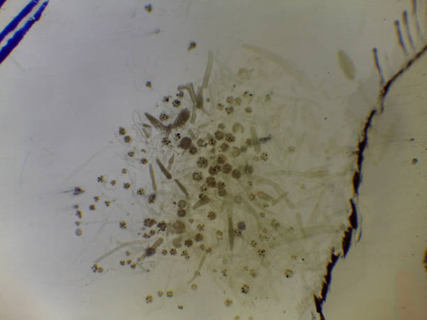 istock Unstained Micrograph of Saprolegnia Oomycete Sexual Structures: Oogonia Filled with Developing Oospo 2249390220