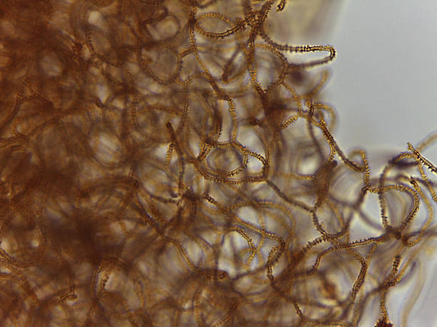 istock Detailed Microscopic View of Slime Mold Spore Dispersal Structures: Intricate Brown Capillitial Threads of Arcyria Ge 2249390222
