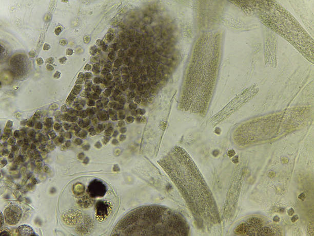 istock Unstained Micrograph of Saprolegnia Oomycete Sexual Structures: Oogonia Filled with Developing Oospo 2249390236