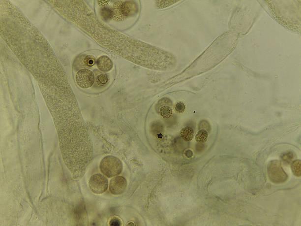istock Unstained Micrograph of Saprolegnia Oomycete Sexual Structures: Oogonia Filled with Developing Oospo 2249390249