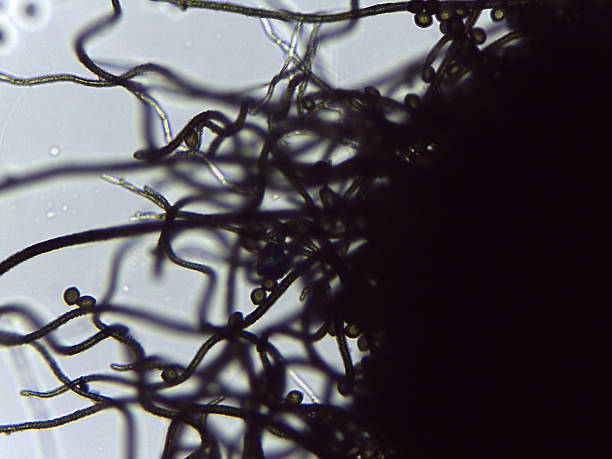 istock Microscopic View of Chaetomium Fungi Perithecium, Showing Diagnostic Dark and Intricate Hairs for Taxonomic Identificatio 2249390392