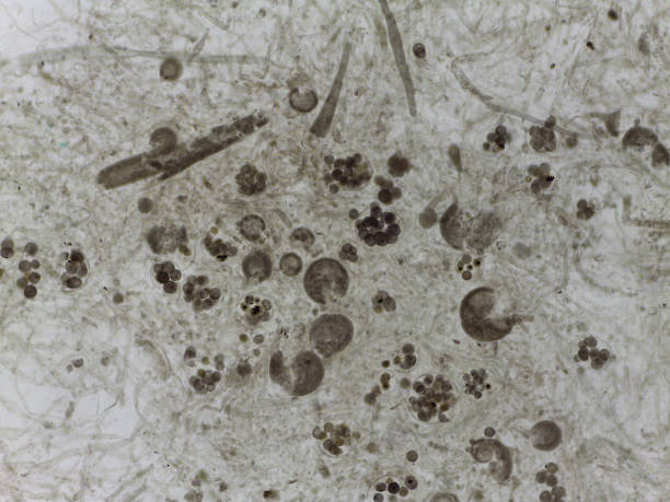 istock Unstained Micrograph of Saprolegnia Oomycete Sexual Structures: Oogonia Filled with Developing Oospo 2249390659