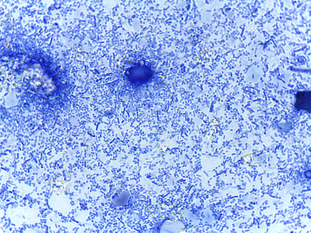 istock Methylene Blue Stained Micrograph of Mixed Bacterial Flora from a Human Fecal Smear Samp 2249408024