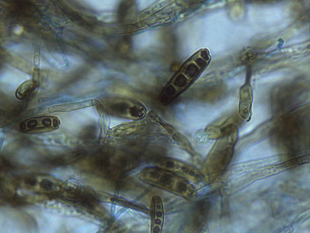 istock Stained Light Micrograph of Multispored Asci (Ascospores) within Hyphae, Indicating Sexual Reproduction in Ascomycota Fungi 2249481508