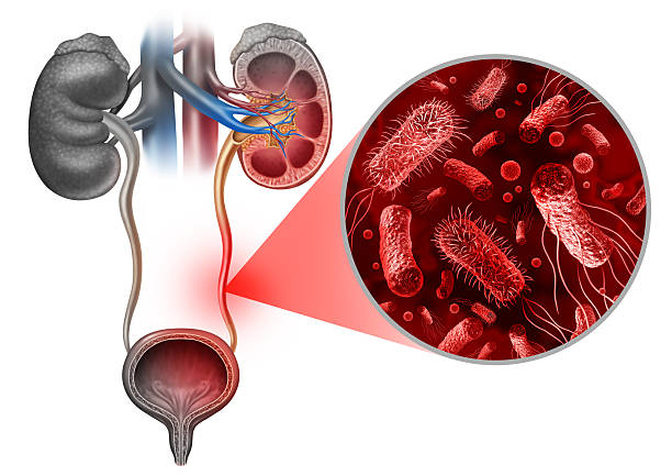 istock Urinary Tract Infection Medical concept 2249829960