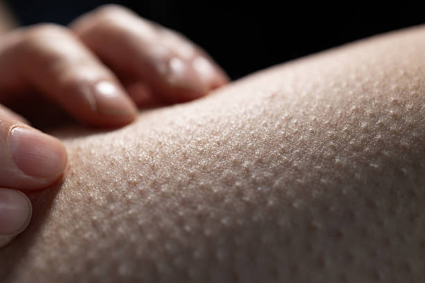 A hand lightly touches skin with raised bumps as a reaction to cold air. The surface appears smooth but has distinct goosebumps all over. This scene captures a moment of physical response.