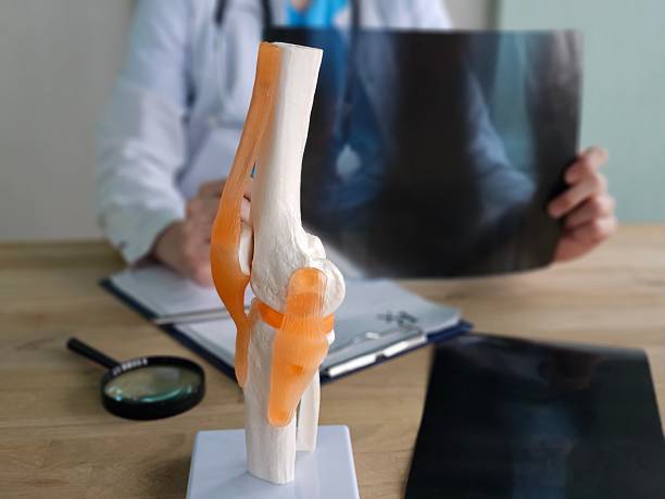 istock Study of a knee joint model during a medical consultation with X-ray analysis 2250068884
