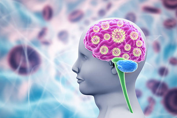 istock Viral meningitis and encephalitis 2250084306