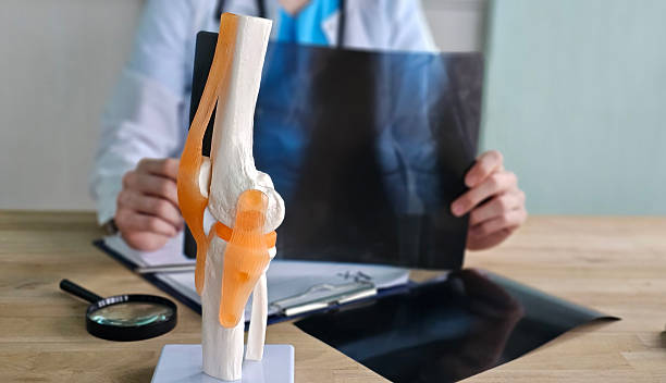 istock Doctor examines knee model while reviewing X-ray of patient 2250762025