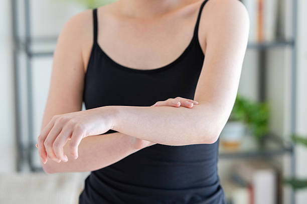 istock Young woman suffering from rough skin 2251473392