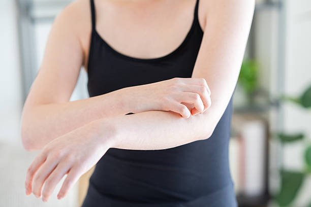 istock Young woman suffering from rough skin 2251473398