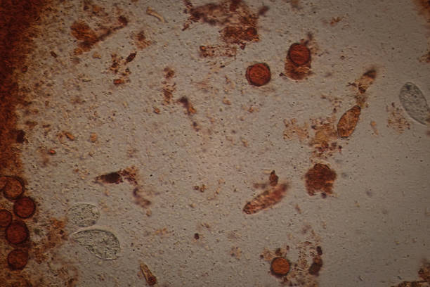 Microscopic Field View of a Putrefaction Sample, Revealing Fungal Spores, Microbial Debris, and Protozoan Life Forms