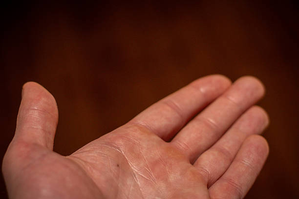 istock Open human palm with natural skin texture 2251746127