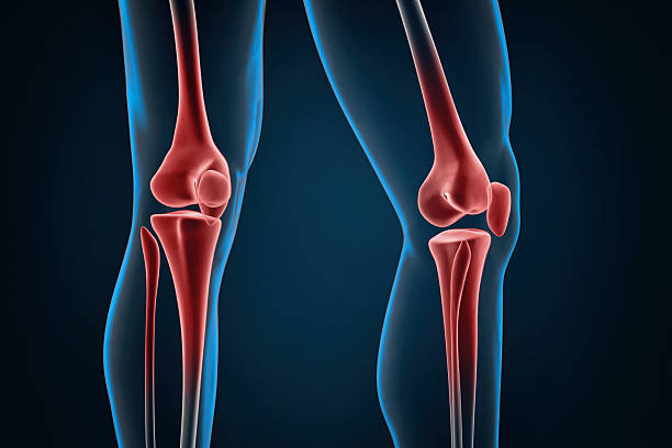Injured knees close-up. 3D illustration.