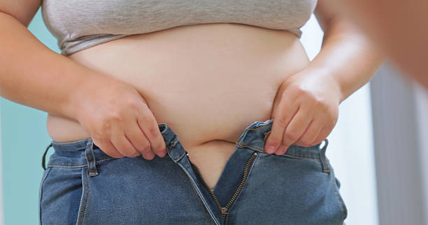 istock obese woman struggling to button her pants 2251956905