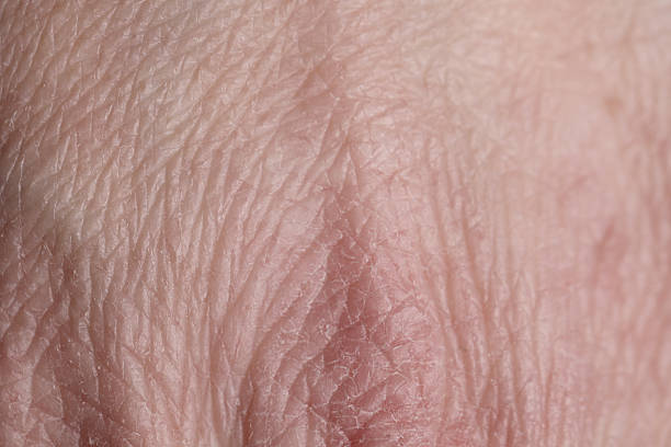 istock Texture of dry skin as background, closeup 2252054844