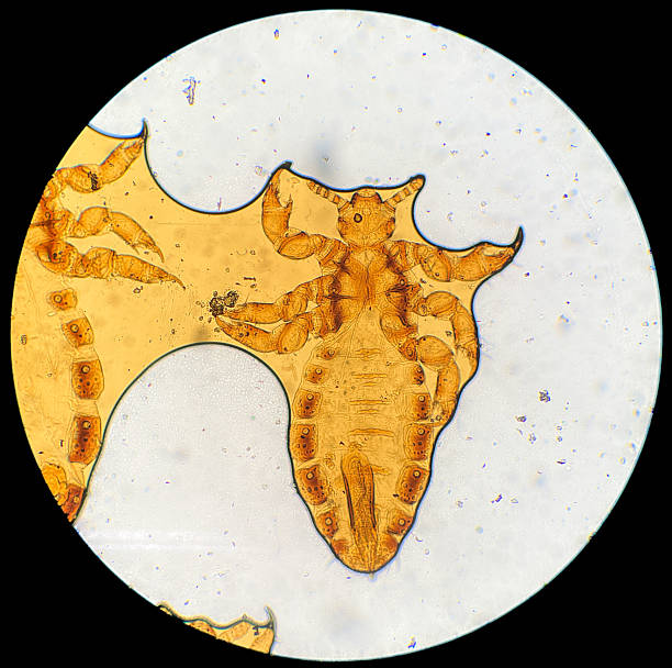 This detailed microscopic photograph reveals the intricate anatomy of a louse, an ectoparasitic insect. The image showcases the insect's segmented body, prominent antennae, and specialized clawed legs adapted for gripping mammalian hair.  The yellow-brown hue and high magnification highlight the fine details of this arthropod.