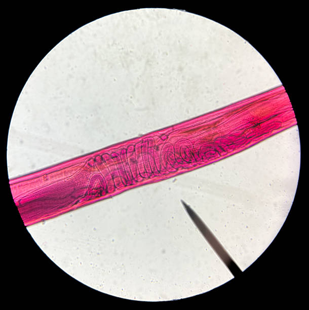 Host cells with spores (mold) are inside wood under the microscope for education.