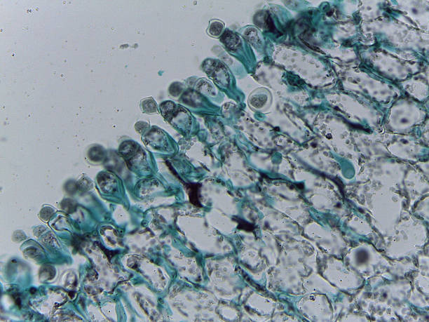 istock Microscopic Visualization of Cystopus Candidus Albugo White Rust Fungal 2252527778
